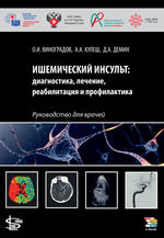 Ишемический инсульт: диагностика, лечение, реабилитация и профилактика