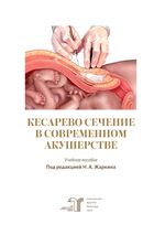 Кесарево сечение в современном акушерстве